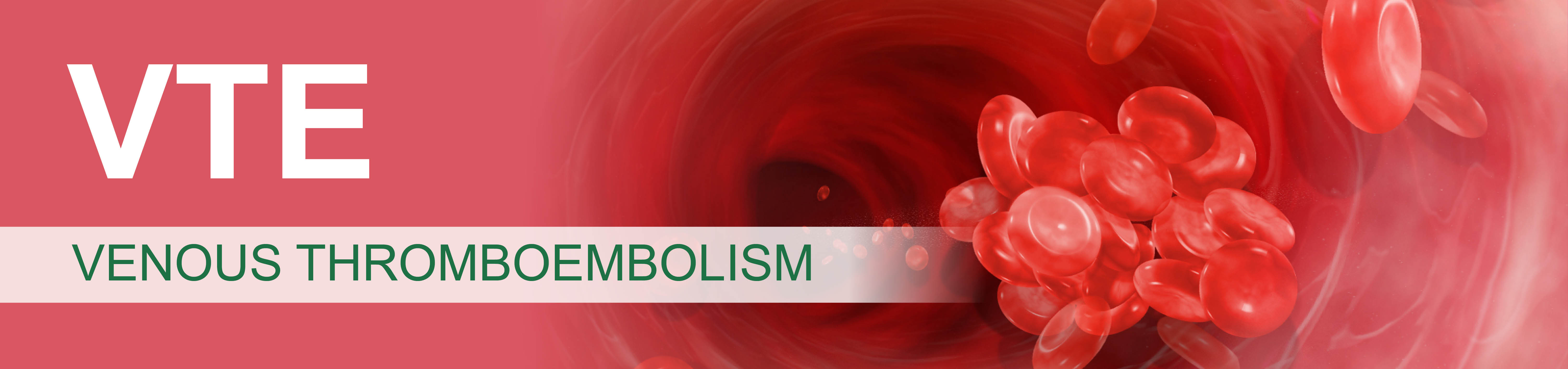 VTE: Venous Thromboembolism